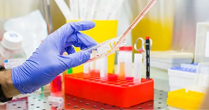 Peptides in Diabetes